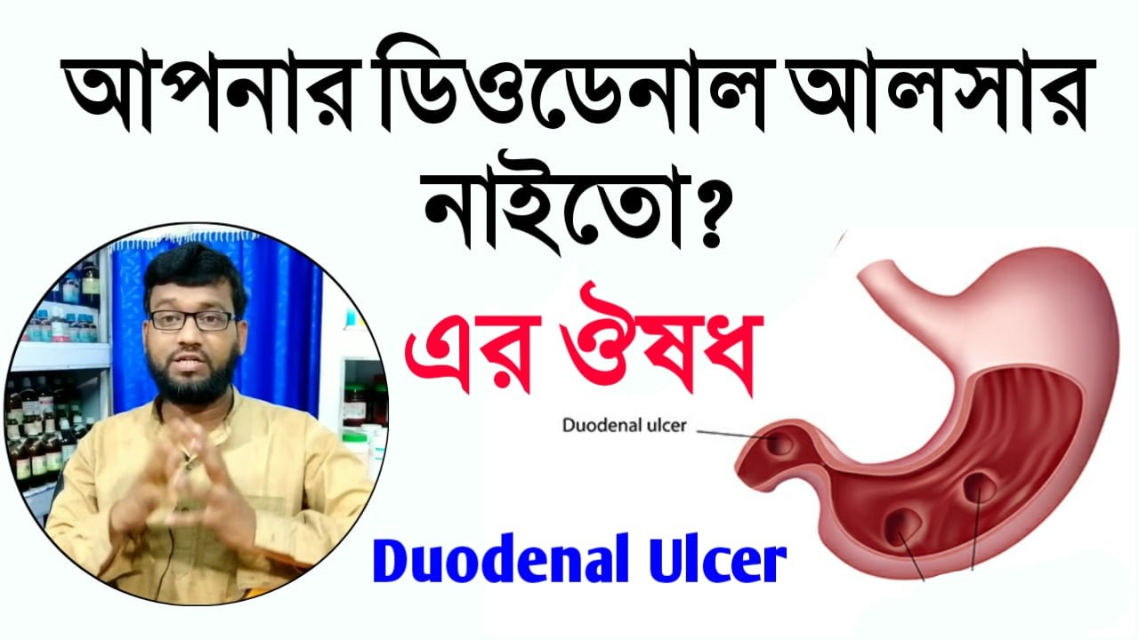 ডিওডেনাল আলসারের হোমিওপ্যাথি ঔষধ ও চিকিৎসা | duodenal ulcer homeopathy medicine