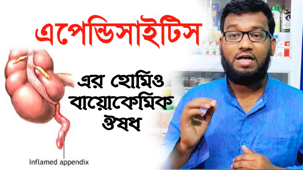 এপেন্ডিসাইটিস এর হোমিও বায়োকেমিক ঔষধ | appendicitis homeopathy medicine in Bengali