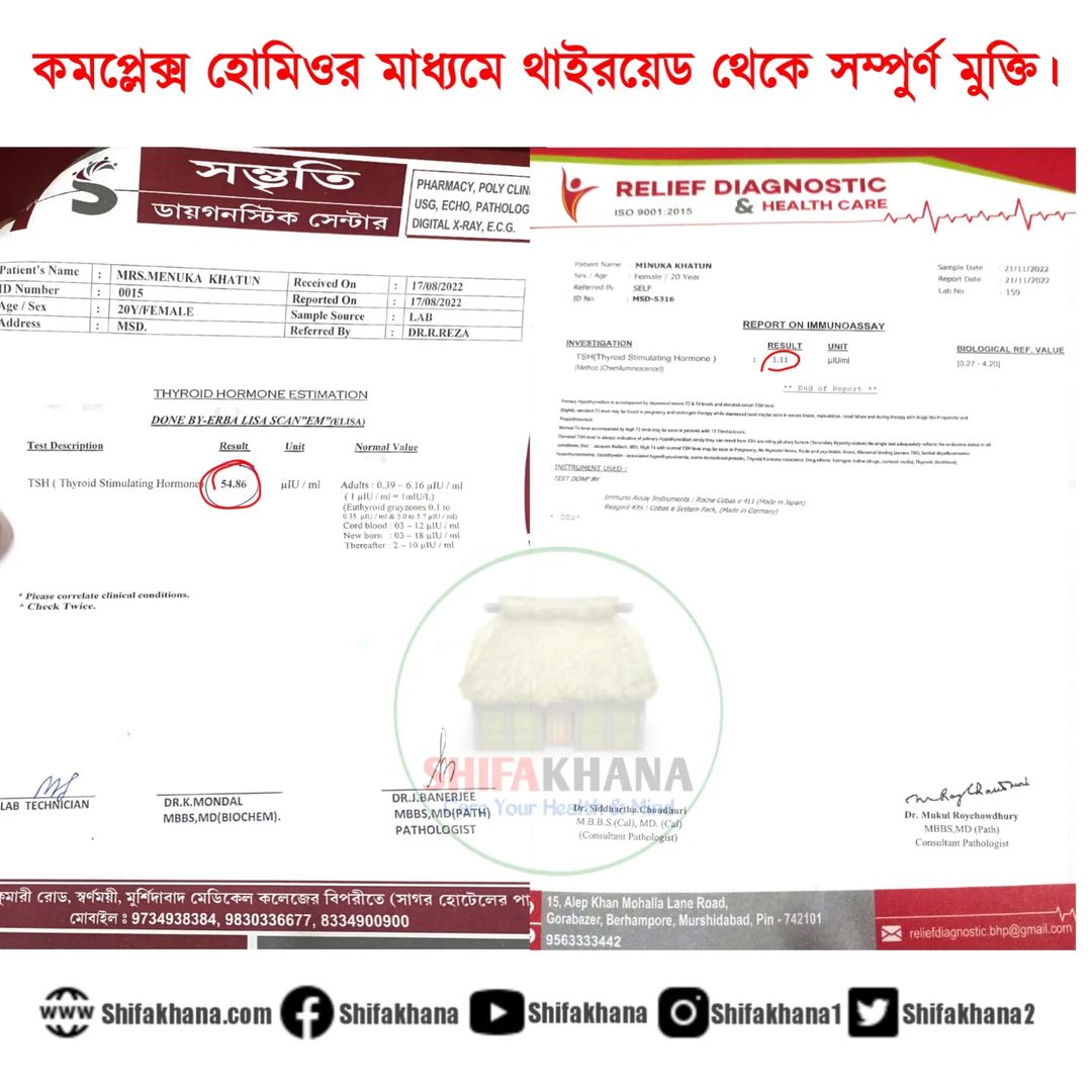 কমপ্লেক্স হোমিওর মাধ্যমে হাইপো থাইরয়েড সমস্যা থেকে সম্পুর্ণ মুক্তি।…